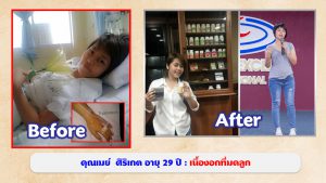 คุณเมย์ ศิริเกต เนื้องอกที่มดลูก